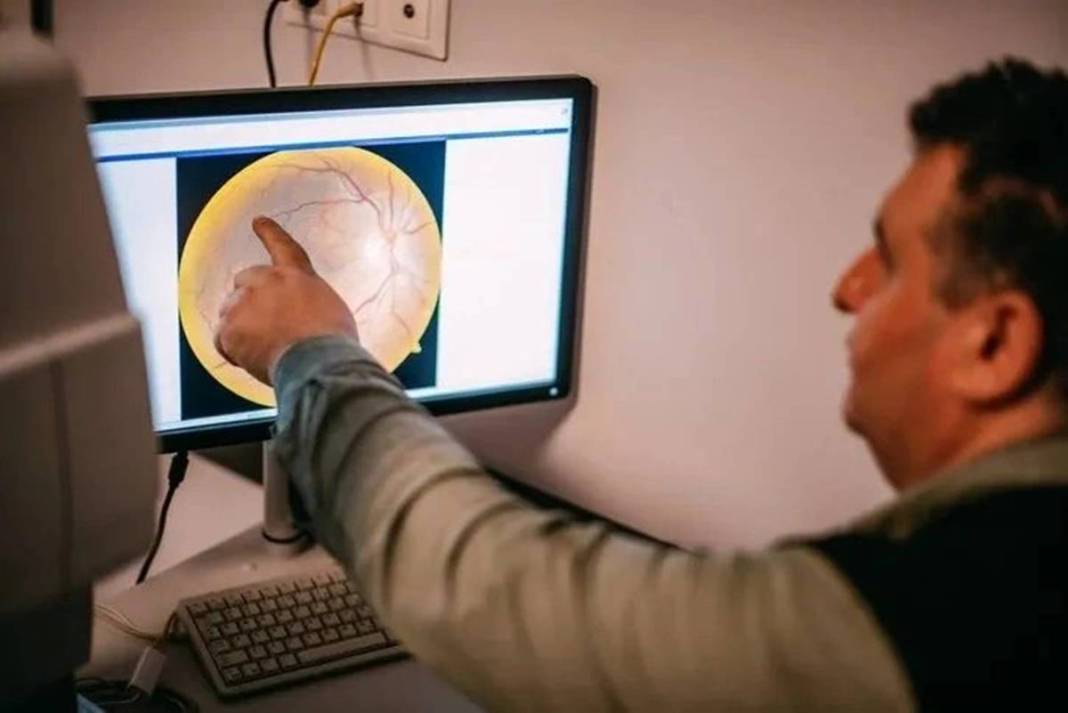 Takma kirpik taktı, kör oluyordu: Gözünün rengi değişti! Sizin de başınıza gelebilir, bu hataya düşmeyin 11